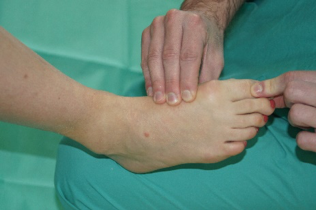 Clinical ankle 12.png
