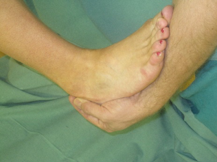 Clinical ankle 9.png