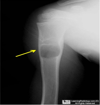 Figure 3 X ray 3.png