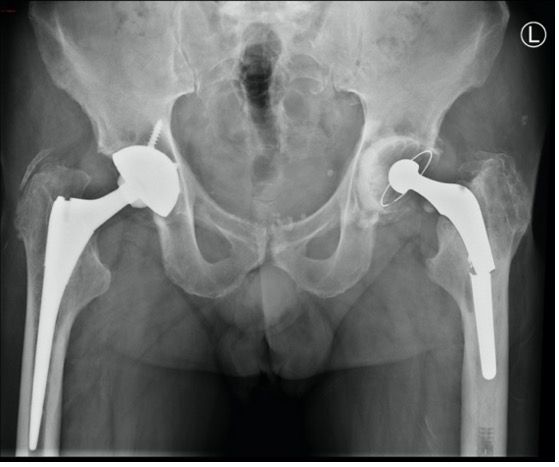 Topic - Postgraduateorth Opaedics