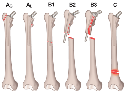 Topic - Postgraduateorth Opaedics